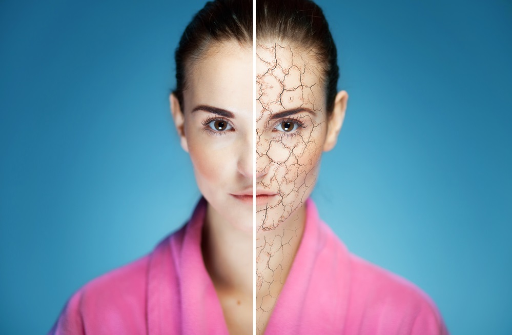 Dry Skin During Winter Di MYOOR dry-skin-during-winter-di-myoor